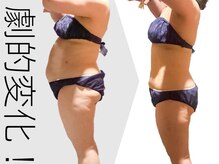 ビューティーリバース 大船店の雰囲気（モニター様キャビ/セルムで1ヵ月-4.1kg/ウエスト-8cm達成！）