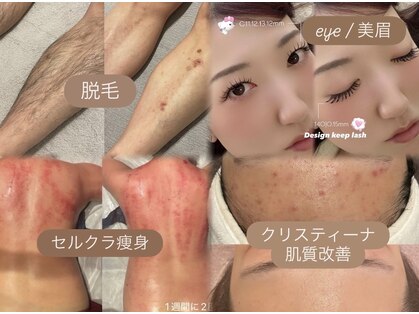 エクラ(eclat)の写真