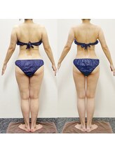 アユアランリンク 札幌店/50代/NEWスムージー/2ヵ月/-7kg