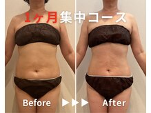 エピデリ 福岡大濠(EPI de RIZ)/【痩身/ダイエット】1ヶ月集中