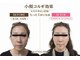 STBの写真/小顔コルギ×ヘッド×モデリングパックで速攻小顔へ。専門スタッフ施術で理想のフェイスラインを実現