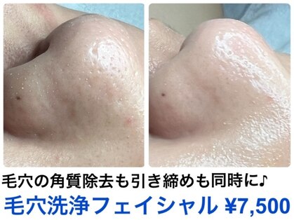 ピュアビューティー(PURE BEAUTY)の写真
