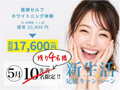 ハイティース 高田馬場店(Hi Teeth!)の写真
