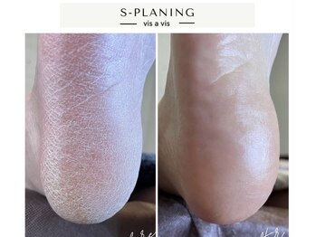 ネイルスペース ヴィザヴィ(NailSpace Vis-a-vis)の写真/韓国式足裏角質ケア導入！S-PLANING◎ツルツルふわふわの足裏体験をぜひ♪※その他フットネイルケアあり◎