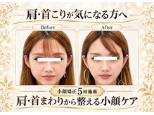 ワンモア 新町店(1MORE)