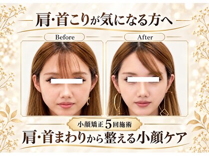 ワンモア 新町店(1MORE)の写真