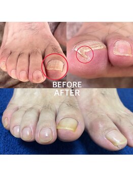 ビビィ(vivie)/足先の違和感、ご相談ください