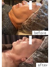 トモズサロン28(Tomos.salon.)/フェイスラインのもたつき改善！