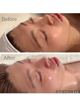 クリーンアンドビューティ 札幌(Clean&Beauty)/次世代ララピールのラミピール♪