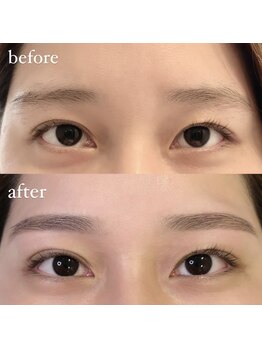 ロウ ボーテ(ROW beaute)/下がり眉を平行に