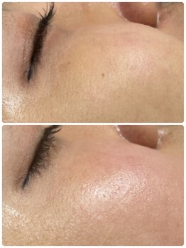 アスピリア(aspirer a')/石膏パックでワンランク上の艶肌