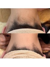 エリクサー 熊谷店(Elixir)/夏が終わっても人気のうなじ脱毛