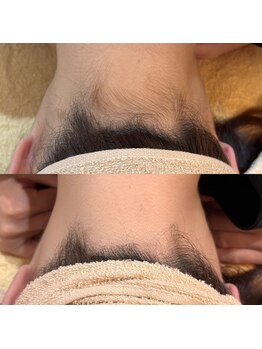 エリクサー 熊谷店(Elixir)/夏が終わっても人気のうなじ脱毛