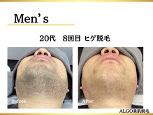 アルゴ 堺東駅前店(ALGO)の雰囲気(【メンズ脱毛】ワックス脱毛+光脱毛で即日効果実感。)