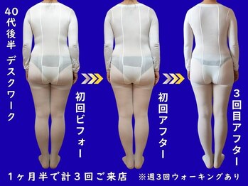 ビエル 掛川店(Bielle)の写真/【本気痩せ！潰して流す！】痩身マシン×オイルリンパのW施術+発汗★徹底痩身★痩せやすい身体づくりへ