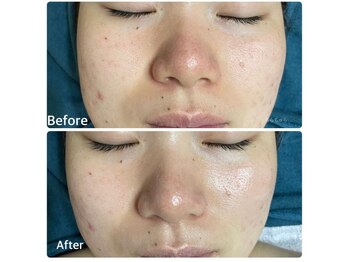 ちらちゅら/クリスティーナ【ビオフィート】