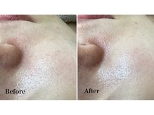 ルピア(L'pur)/つや肌★