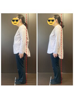 エムエー(ma)/カイロプラクティック施術