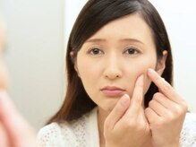 脱毛サロン アンジェ 浦安店