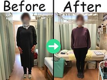 杉本接骨鍼灸院/【ダイエット】42歳　10.7キロ