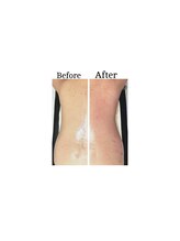 ワイドット(Y.)/美ボディーダイエット/1回の変化