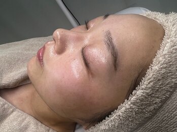 リリ(RiRi)の写真/【韓国発祥の肌管理】しみ,しわ,たるみ,ニキビケア◎どんな肌質でも肌質革命!トーンUPも叶う艶玉肌コース♪