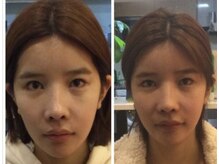 本格整体院 日本橋/