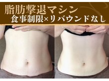ミーティア(Meteor)の雰囲気（【リバウンドなし】食事制限なしでほっそり＆引き締まり実感！！）