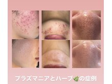 ビューティリュクス(beauty luxe)の雰囲気（諦めていた肌トラブルもプラズマジェットで肌に優しく結果出し！）