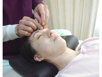 ミズノ接骨院 ミズノ鍼灸マッサージ院/お肌の改善に美容鍼