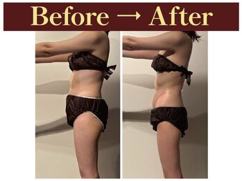 グレースフルタイム プレミアム(Graceful Time PREMIUM)/ビフォーアフター