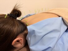 茶ノ木鍼灸整骨院