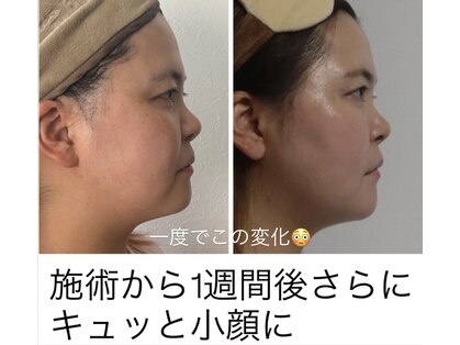 ポエマ(POEMA)の写真