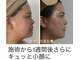 ポエマ(POEMA)の写真