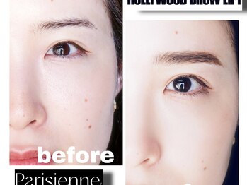 リリオ(Lirio.)/ハリウッドブロウリフト