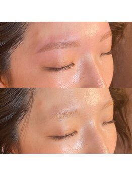 スリーノッツ(THREE KNOTS)/【ハリウッドブロウリフト】