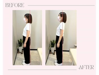 美骨鍼灸整骨院/首肩こり整体マッサージ