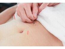 美容鍼灸salonまつもと/