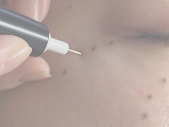 モフ(mof.)の写真/≪じっくり集中シミケア☆≫大人女性に人気◎肌本来の力を整えることで自然にクリアな印象へ導きます！