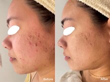 レヴィア 高岡店(REVIA)