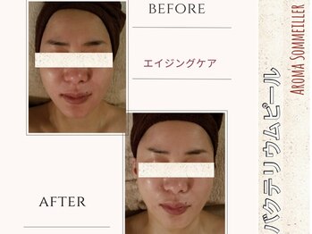 アロマ ソメイエ(Aroma Sommeiller)/バクテリウムピール★ふわ艶肌♪