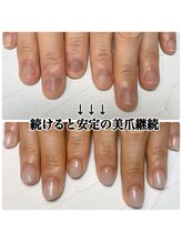 スマイルニコ(smile nico)/