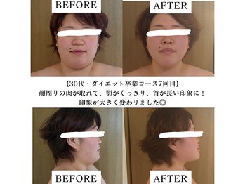 ヨサパーク アーバンヘブン 目黒(YOSA PARK Urban Heaven)/短期期間で集中ダイエット!