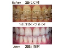 ホワイトニングショップ 池田店の雰囲気（独自開発のジェルで圧倒的な白さへ◎最短2週間♪矯正中の方も◎）