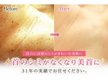 サロンドエステケイワイ(de KY)の雰囲気(首・体・まぶた・唇の濃いシミにもく対応します|フェイシャル)