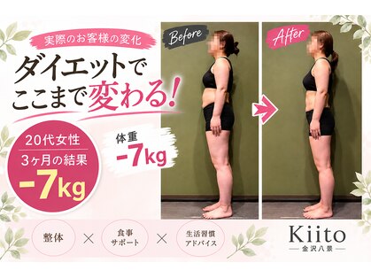 キート美容鍼灸 整体院(Kiito美容鍼灸 整体院)の写真