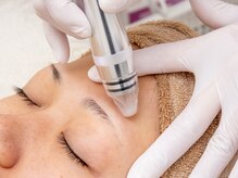 シャルム(Charme)/クリスタルピーリング