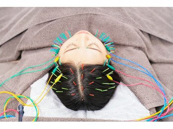 ヴィーライン 大阪梅田院(VeLine)/形状記憶美容鍼＋頭皮鍼