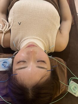 ハリファ鍼灸院 福岡博多院(HariFa鍼灸院)/施術風景