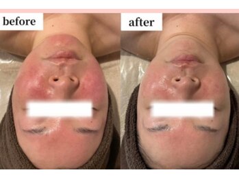 ラポール 野並店(Rapport)/